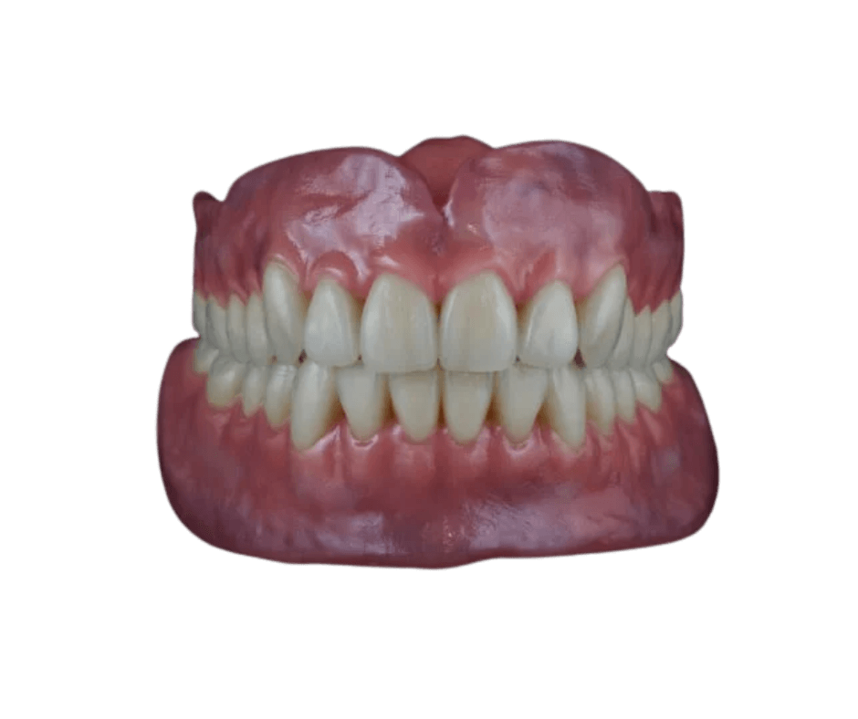 CW Denture | CW Dentures | CW Dentures