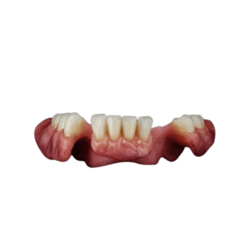 Partial Denture | CW Dentures | CW Dentures