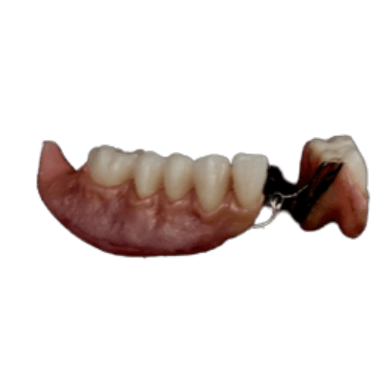 Partial Metal Frame | CW Dentures | CW Dentures