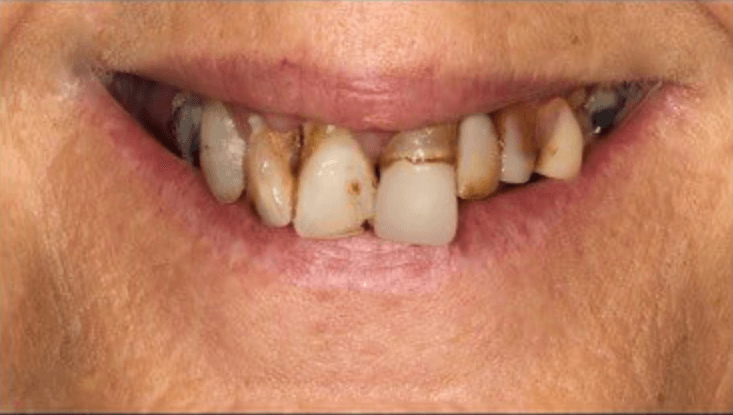  | CW Dentures
