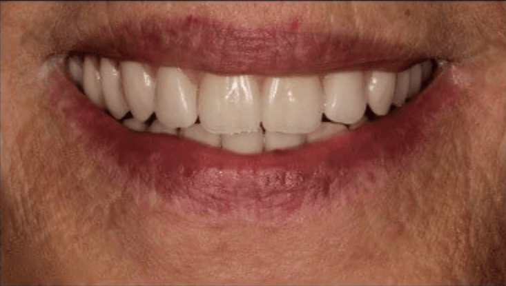  | CW Dentures
