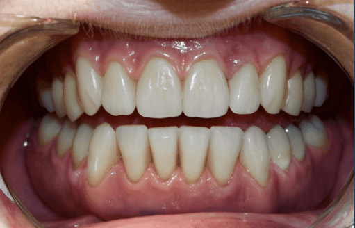  | CW Dentures