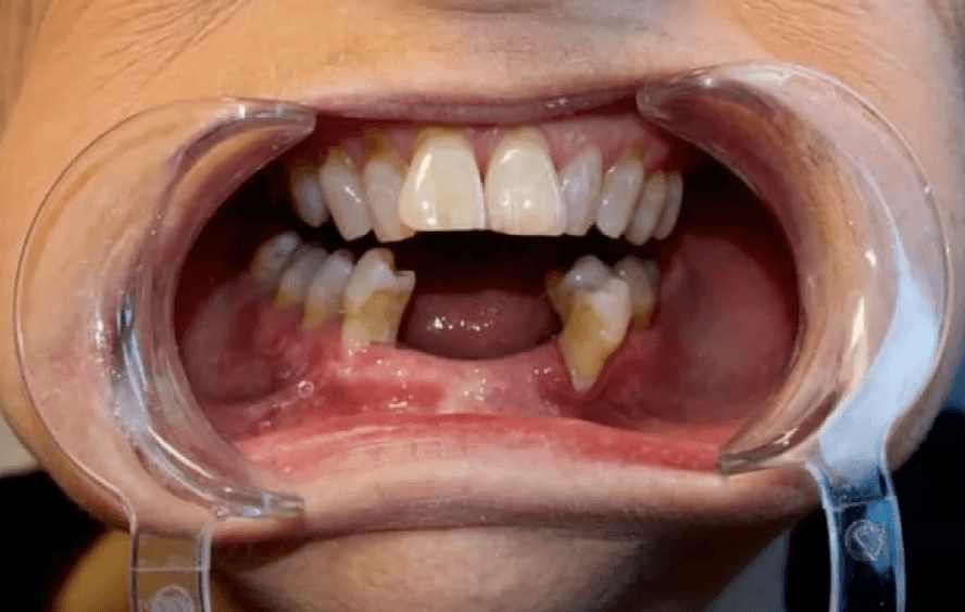  | CW Dentures