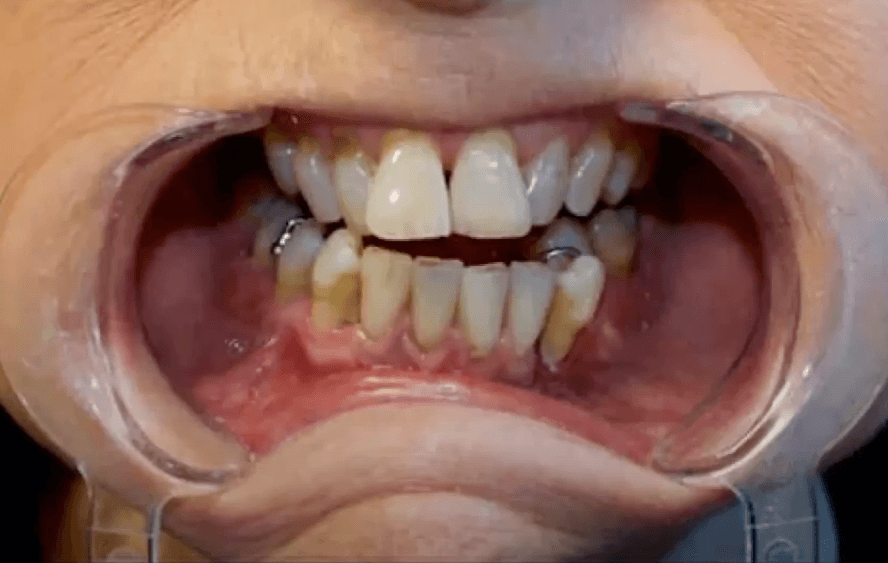  | CW Dentures